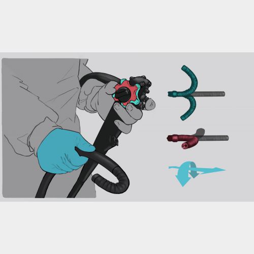 Endoscopic control .jpg