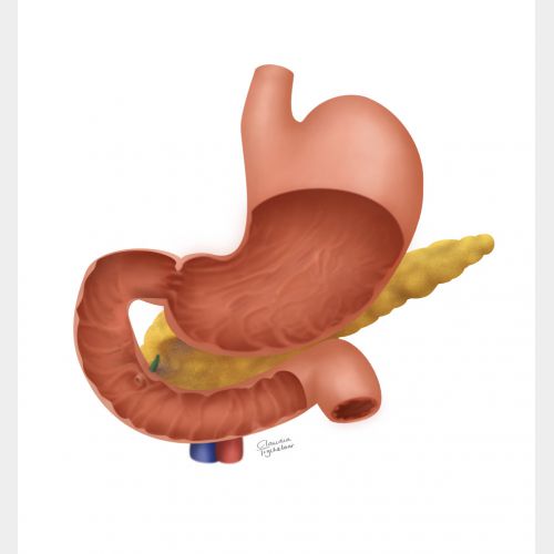 anatomie merk zonder tumor.jpg